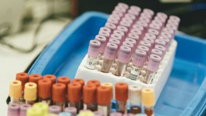 Barcelona lidera un estudi sobre l’ús dels antivirals en el tractament de la grip