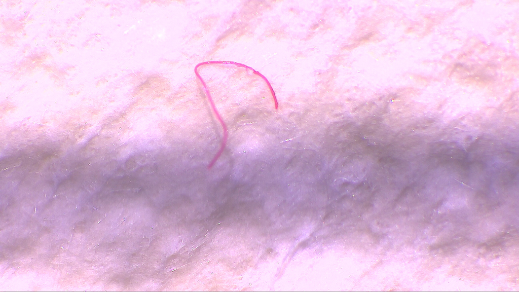micropl&agrave;stic