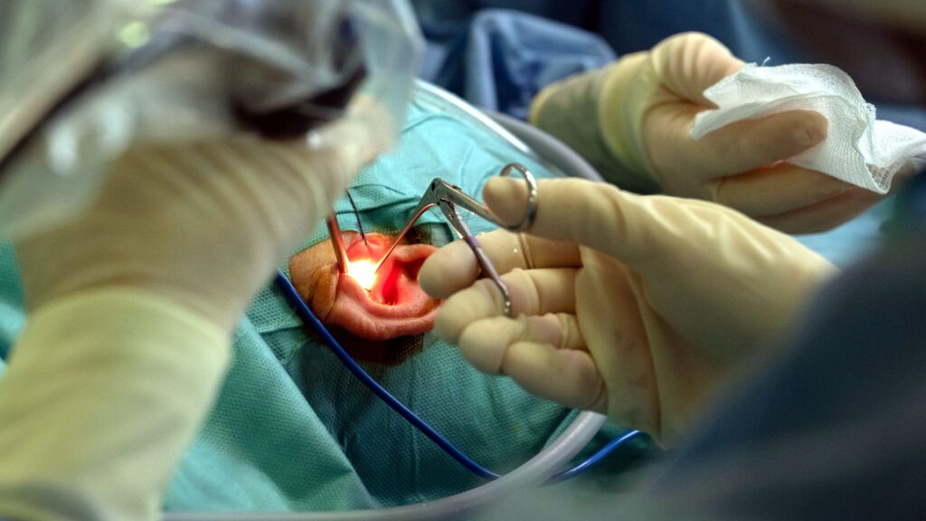 Cirurgia endoscopia o&iuml;da hospital Cl&iacute;nic