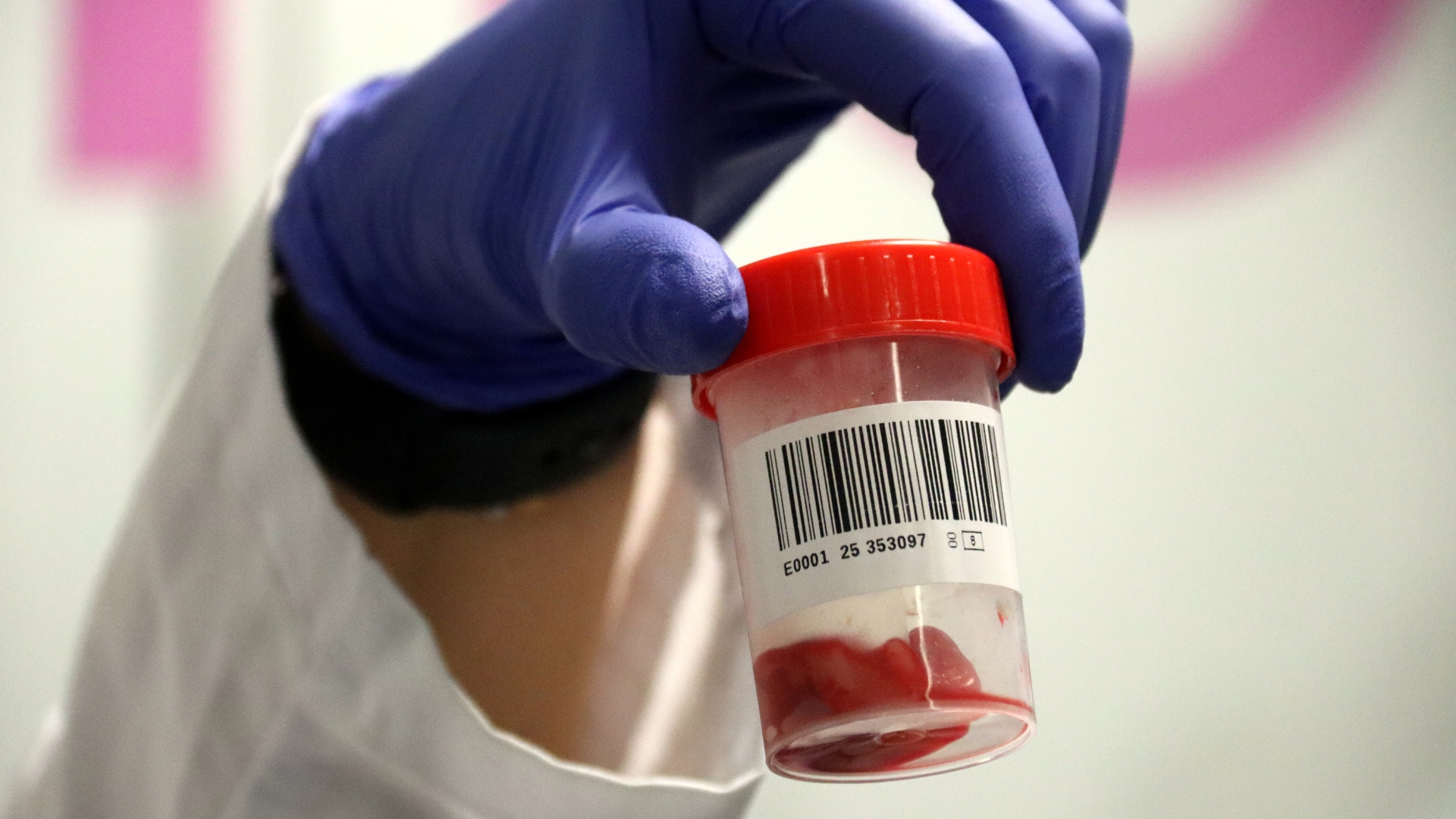 El Banc de Cordó umbilical fa 30 anys amb el repte de remuntar donacions | Banc de Sang i Teixits, donacions de sang, dones, embarassades, hospitals