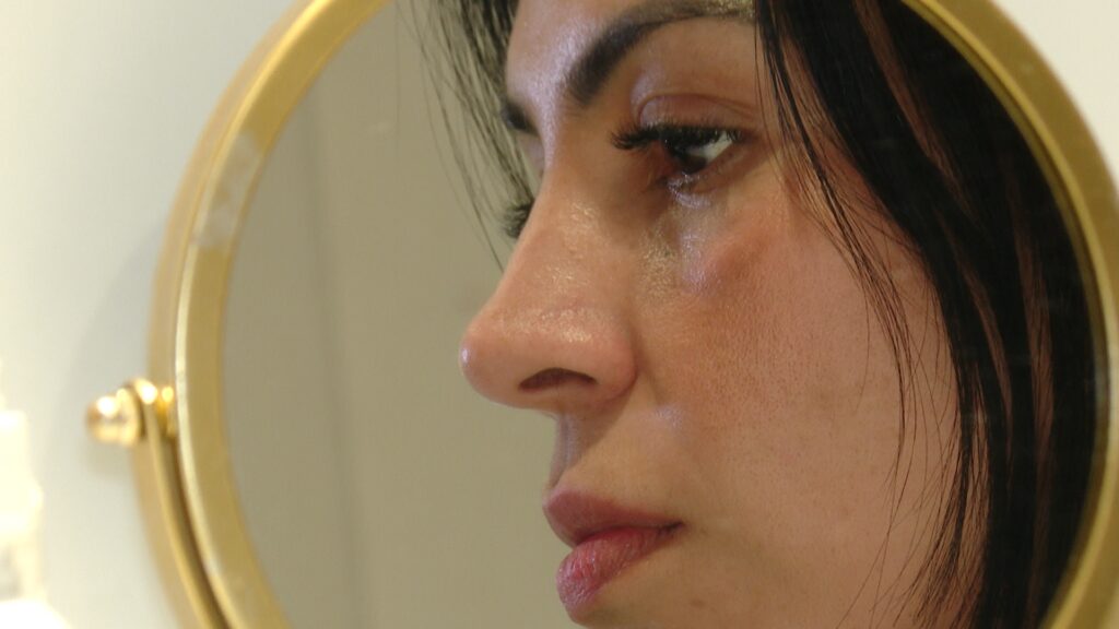 El malson del turisme estètic "low cost": "Volia gastar poc i he acabat pagant un preu molt alt" | Barcelona, salut mental, salut pública