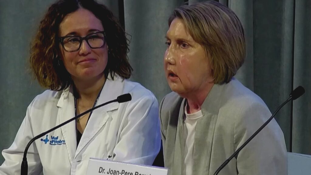 El Vall d'Hebron fa el primer trasplantament de cara amb una donant que va rebre eutanàsia | Hospital Vall d'Hebron, trasplantaments