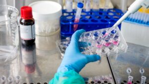 L’Hospital del Mar identifica com el càncer de còlon fa metàstasi al fetge