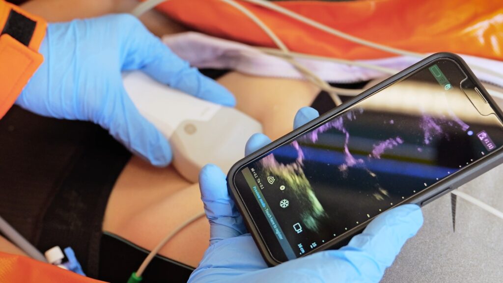 Les noves ambulàncies del SEM podran fer ecografies i analítiques de sang immediates | Accidents, emergències, hospitals, SEM