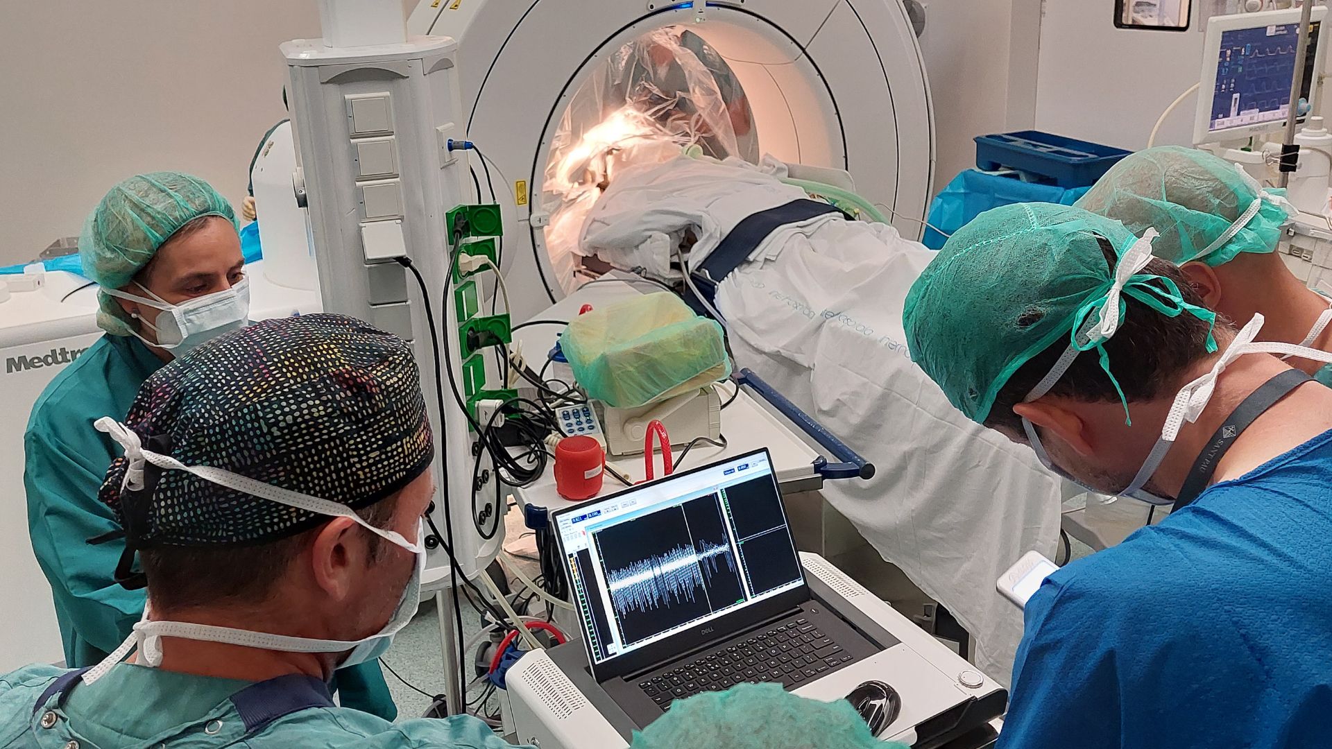 Estimulació cerebral profunda en un pacient amb Síndrome de Tourette l'Hospital de Sant Pau