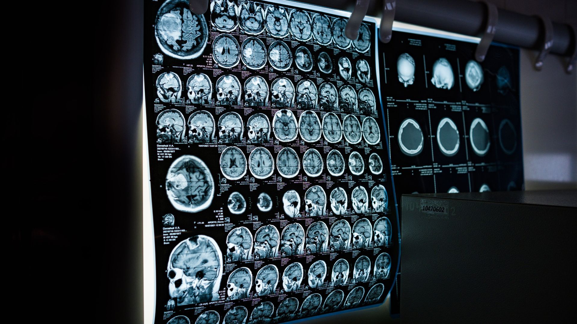 estudi cervell pantalla